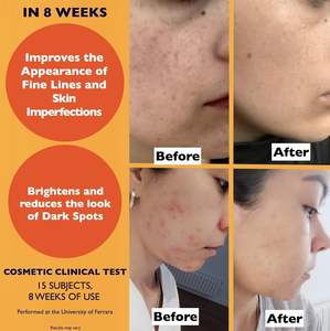 Suero de Vitamina C y Ácido Hialurónico de Marca Privada, Iluminador e Hidratante para Piel Seca y Sensible - Product Image 2