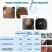 2billion Exos GHK-Cu Polvo Liofilizado para el Crecimiento del Cabello, Solución Profesional Anticaída, Estimulación de Folículos, Tratamiento de Regeneración