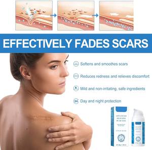 Gel réparateur de cicatrices en <span class=keywords><strong>silicone</strong></span> ETRUN ALISA, marque privée, efficace contre l'acné, les boutons, les vergetures, les marques de cicatrices, crème anti-cicatrices - Product Image 3