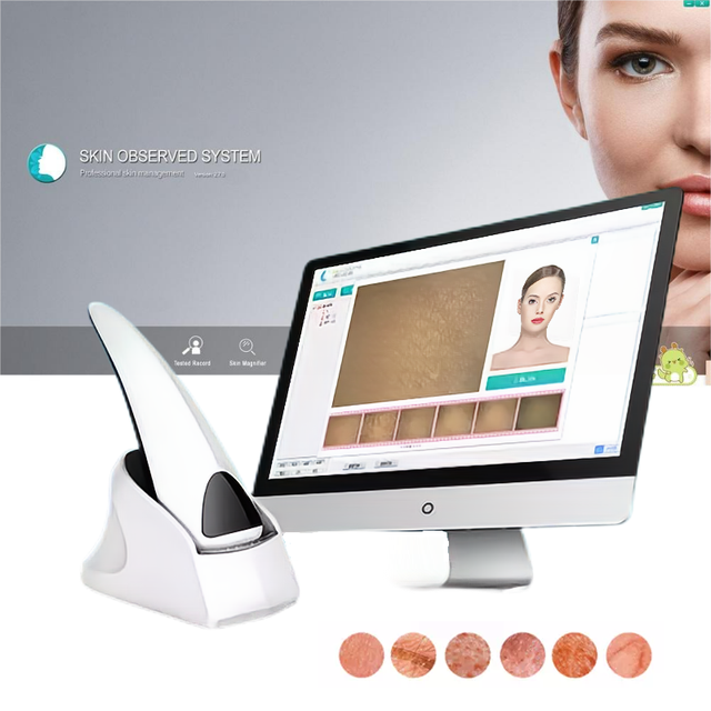 Factory Wholesale High-Definition Detector Skin Care Beauty Instrument Intelligent Digital Skin Analyzer