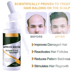 Saç <span class=keywords><strong>d</strong></span>ökülmesi önleme ve büyüme promosyonu için OEM 60ml organik biberiye yağı saç rejenerasyon özü saç tamir özelliği - Product Image 3