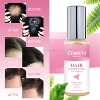 Label privé 100% naturel à base de plantes nourrissant élixir pour le cuir chevelu huile de ricin romarin soin des cheveux traitement de la perte de cheveux sérum d'huile de croissance des cheveux