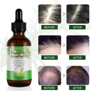 Aceite Esencial de Romero orgánico Natural para mujer, productos para el cuidado del cabello negro, para el crecimiento del cabello
