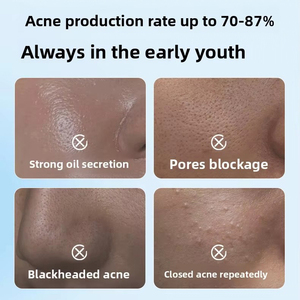 Limpiador facial personalizado para jóvenes con control de aceite y eliminación de acné ingredientes herbales espuma hidratante para niños niñas <span class=keywords><strong>en</strong></span> la <span class=keywords><strong>pubertad</strong></span> - Product Image 2