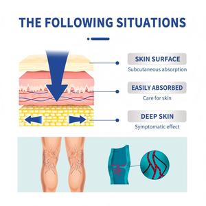Crème pour les varices OEM personnalisée, crème apaisante pour les <span class=keywords><strong>jambes</strong></span> bleues, soulagement de la douleur et de l'enflure, réparation, massage, soin de la peau, crème pour les <span class=keywords><strong>jambes</strong></span> à base de plantes - Product Image 3