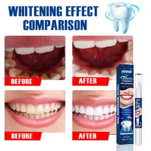 <span class=keywords><strong>Stylo</strong></span> blanchissant pour les dents, éliminateur de taches de café et de thé, <span class=keywords><strong>stylo</strong></span> compact pour un sourire éclatant, pour hommes et femmes, soin buccal quotidien - Product Image 3
