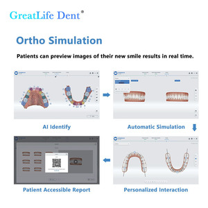 <span class=keywords><strong>Shining</strong></span> <span class=keywords><strong>3D</strong></span> Aoralscan L: Solución de Escaneo Digital Dental Optimizada en la Nube, Aleación de Aluminio Aeronáutico, 1 Año de Garantía, CE ISO - Product Image 4
