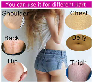 تمتد علامة كريم البشرة كريم تبييض البشرة الداكنة ، إزالة الندوب كريم العناية ببشرة الحمل إصلاح كريم - Product Image 3