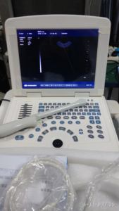 Longermay Ecógrafo Veterinario de Tableta a Color Portátil Máquina de USG Escáner de Ultrasonido Portátil Totalmente Digital en B/N para Humanos - Product Image 6