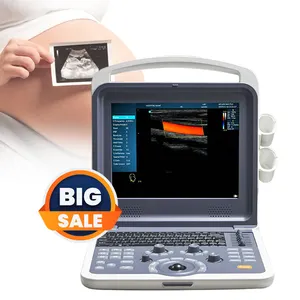 Giá thấp nhất y tế máy siêu âm xách tay đầy đủ kỹ thuật số màu DOPPLER máy siêu âm