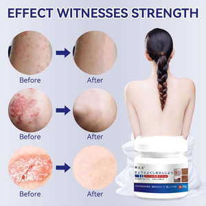 Оптовая продажа травяного крема от лишая, экземы, зуда, акне, грибковых инфекций, антибактериальная мазь - Product Image 6