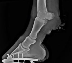 SY-D4343-1医療用17x17インチマンモグラフィデジタルフラットパネル検出器CSIDrパネル検出器 - Product Image 2