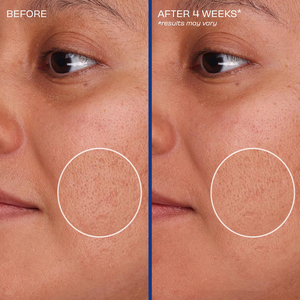 Private Label blu rame Peptide prodotti per la cura della pelle Anti invecchiamento rughe ridurre le linee sottili Lifting siero viso per la cura del viso - Product Image 6