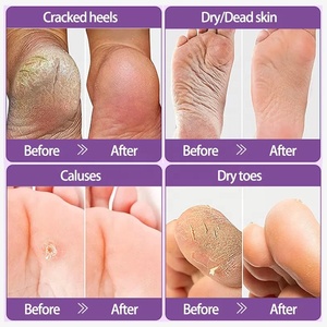 Prezzo basso all'ingrosso 40g Private Label maschera Peeling per la cura dei piedi biologica rimuovi la pelle morta maschera esfoliante per i piedi alla lavanda - Product Image 6