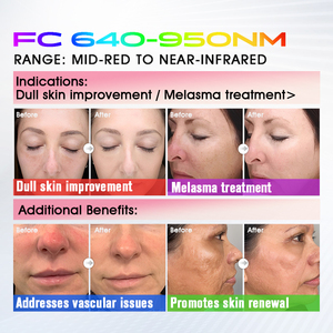 Máquina de Rejuvenecimiento Facial y Corporal BBL <span class=keywords><strong>Plus</strong></span> de Larga Duración, Instrumento Reafirmante Antienvejecimiento de Doble Uso - Product Image 6