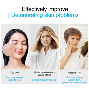 Sérum à la niacinamide 10% SEFUDUN 30ml, soin hydratant pour la peau, traitement de l'hyperpigmentation, anti-âge, sérum ordinaire à la niacinamide - Product Image 6