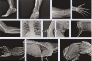 Sistema Portátil de Rayos X de 70kV 85kV para Clínicas Veterinarias, Imágenes en Tiempo Real, Sistema de Rayos X Inalámbrico <span class=keywords><strong>DR</strong></span>, Fluoroscopia - Product Image 5