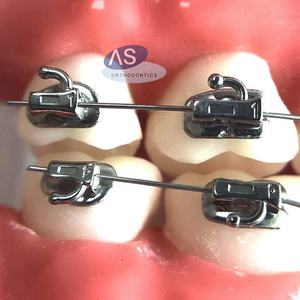 Ortodoncia primi tubi molari <span class=keywords><strong>in</strong></span> metallo - Product Image 4