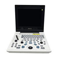 SY-AX50-1 Appareil d'échographie médicale USG le plus populaire pour la grossesse, scanner ultrasonore médical gynécologique portable