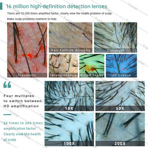 Analizador profesional de cuero cabelludo <span class=keywords><strong>2025</strong></span>, probador de humedad Digital, escáner de folículos pilosos de alta definición para salón de belleza en el hogar, uso en SPA - Product Image 4