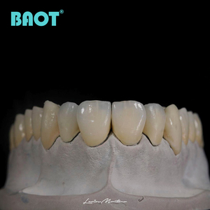 Kit Professionale PFZ per Riempimento Dentale, Set di Materiali in Porcellana, Polvere Ceramica Dentale, Kit Master per Odontoiatri - Product Image 6