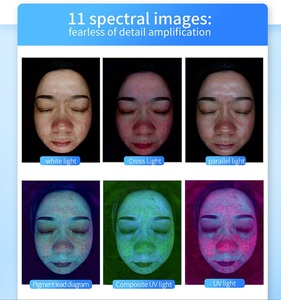 Analyseur de peau le plus populaire, instrument de diagnostic facial, test d'hydratation du visage, analyse faciale, analyse de la peau 3D - Product Image 3