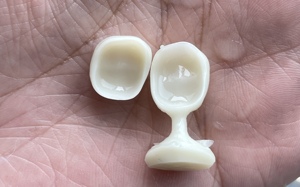 Dentitude Press lingotti in ceramica di vetro al litio disilicato materiale dentale per la realizzazione di impiallacciatura intarsio Onlay corona in laboratorio odontoiatrico - Product Image 6