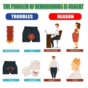 قمر جنوب يجبر بشكل طبيعي كبسولات البواسير ، وتخفيف الحكة من داخل وخارج خليط يغلي الشرج شو معجون اللحوم إليم - Product Image 6