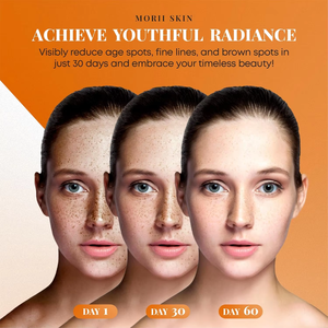 Ensemble de soins de la peau au curcuma biologique naturel, savon fait main, nettoyant visage, mousse nettoyante, nettoyage en profondeur, anti-acné, éclaircissant, hydratant - Product Image 5
