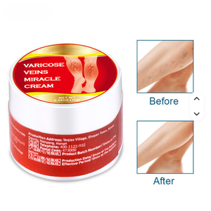 Crema per il Sollievo dalle Varici alle Gambe, Lozione per la Cura del Corpo, Unguento per Gambe Sane, Crampi alle Gambe e Congestione Venosa, Sollievo Esterno - Product Image 6