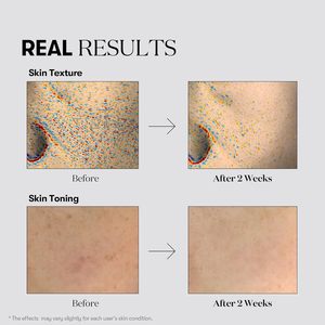 VT TX Tranexamic Acid Toning สำหรับ 1000 ช็อต เซรั่ม 30 มล. สำหรับผู้หญิง บำรุงผิวหน้าขาวกระจ่างใส - Product Image 4