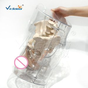 Modèle de cathéter masculin transparent VIC408E, outil pédagogique pour l'éducation sexuelle - Product Image 4