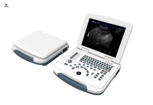 Sistema de Diagnóstico Ultrasónico Digital en Blanco y Negro para Animales, <span class=keywords><strong>Precio</strong></span> de Fábrica, Fabricante y Proveedor Veterinario - Product Image 2