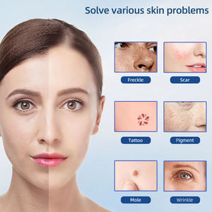 Nouvelle conception de stylo à plasma électrique pour le lifting des yeux, le resserrement des paupières, le raffermissement de la peau du visage, anti-âge - Product Image 4