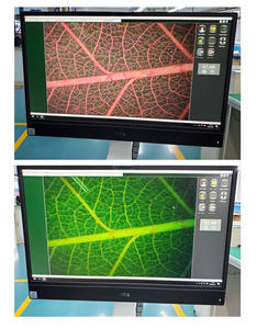 Fabricante clínico portátil máquina de colposcopia de mano cámara de vídeo portátil colposcopio óptico portátil para Ginecología - Product Image 3