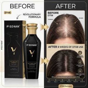 <span class=keywords><strong>Shampoing</strong></span> <span class=keywords><strong>Anti</strong></span>-Chute Bio pour Femmes Souffrant de <span class=keywords><strong>Calvitie</strong></span> Sévère et de Cheveux Fins – Soin du Cuir Chevelu et de la Couronne Capillaire, Réduit le Sébum et la Faible Porosité - Product Image 3