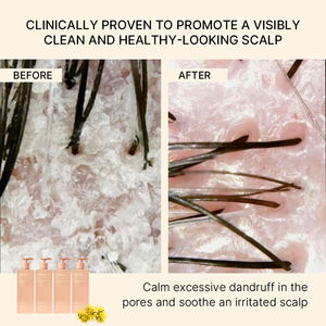 Ensemble de soins capillaires multifonctionnel pour salon professionnel, naturel, végétalien, à l'hamamélis, nourrissant, anti-démangeaisons, shampooing stimulant la croissance pour femmes - Product Image 3