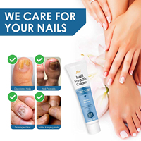 Crème de traitement réparatrice pour ongles d'orteil Crème réparatrice efficace pour ongles épais, cassés et décolorés