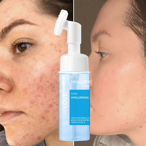 Aloe Vera ácido hialurónico vitamina E limpieza Mousse hidratante suave desmaquillador espuma limpiadora limpiador Facial - Product Image 1