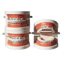 Décorations pour appareils dentaires, fausses attaches, accessoires dentaires temporaires, fils métalliques, ligatures orthodontiques colorées