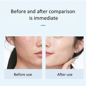 Регулируемый штамп Derma 0-3,0 мм, устройство для микронейдлинга для домашнего использования, таргетированная - Product Image 3