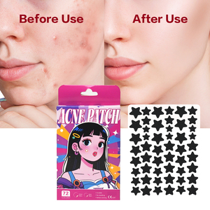 黑色星形痘痘贴 CE 认证 快速愈合水胶体贴片 OEM 品牌可定制 供全球零售商使用 - Product Image 2