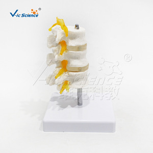 Modèle de vertèbres lombaires à trois segments de haute précision, en PVC, avec structure précise ; une démonstration de pathologie - Product Image 2