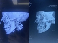 Baik retensi warna Asli Fujifilm medis x-ray pencitraan Film 8X10 10x12 10x14 14x17 inci Laser inframerah Film gastrskopik