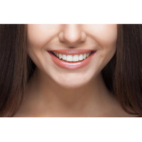 3 ou 4 Teintes /Lot Fausses Dents Temporaires Dentier Appareil Dentaire Prothèse Souple pour un Sourire Parfait Facettes Adhésif Dentaire