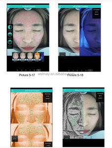 เครื่องวิเคราะห์สภาพผิวหน้า คลินิก สปา ซาลอน เวลเมย์ เครื่องวิเคราะห์สุขภาพผิวหน้า เครื่องวิเคราะห์สีผิวหน้า - Product Image 3