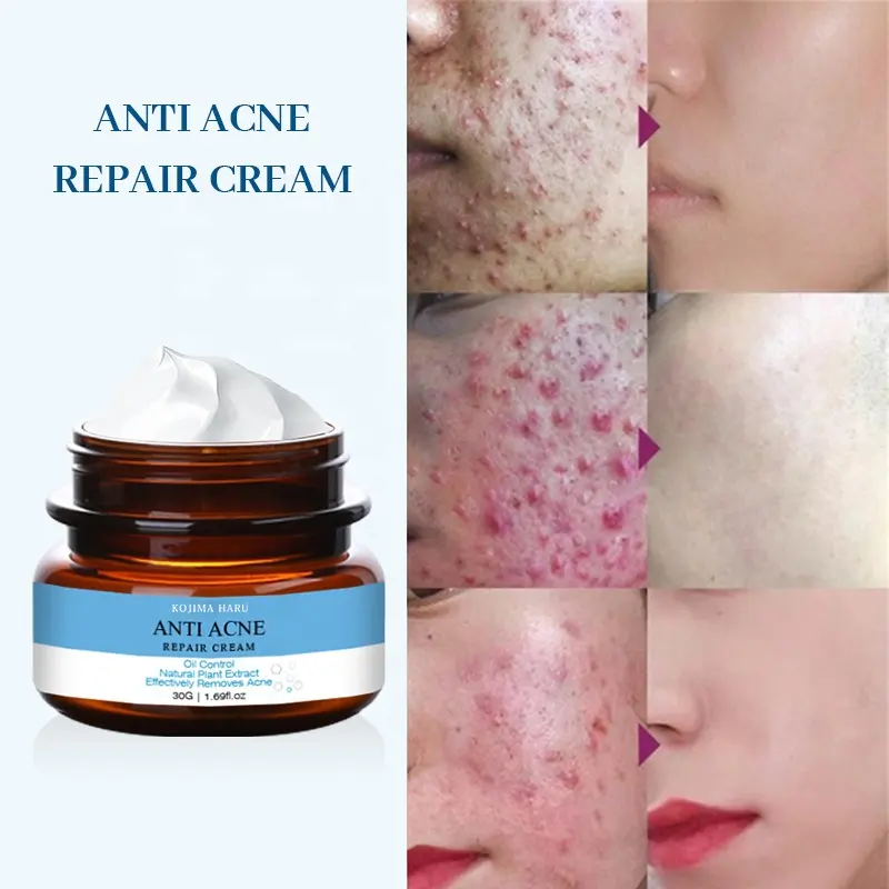 Non irritating Whitening Cream Skin Repair Treatment CREAM Anti Winkles Brightening Cream