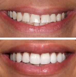 Yucera YRC-6X - Fresadora Dental CNC de 5 Ejes para Laboratorio - Product Image 5