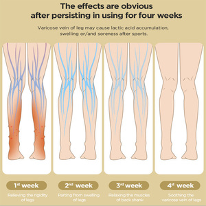 Насос для профилактики тромбоза глубоких вен, пневматический компрессионный терапевтический прибор с рукавом для ног для кровообращения и облегчения боли - Product Image 5
