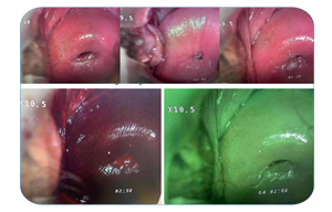 Kernel Binoculaire Colposcopie Met 1 Jaar Garantie - Product Image 2